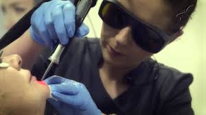 Webinar from june 8th, 2020. Laser Hair Removal Using Cynosure Elite Medical Grade Laser At The Laser And Skin Clinic Youtube