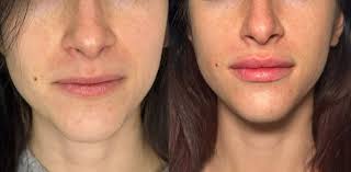 Dott. Alessandro Carraro, medico estetico