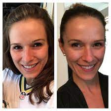 Collagen peptides have become a popular dietary supplement due to their versatile nature and many benefits. Why I Take Collagen How I Use Collagen Physical Kitchness