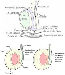 If correcting surgery happens within six hours of. Testicular Torsion Epomedicine