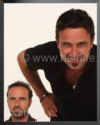 Protez Sac Protez Sac Istanbul Protez Sac Ankara Protez Sac Resimleri Sac Sac Urunleri Ve Sac Dokulmesi