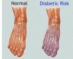 Nerve Pain In Foot Causes Symptoms Diagnosis Foot Pain