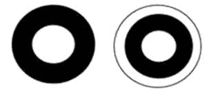 Image result for Visual Field Deficit