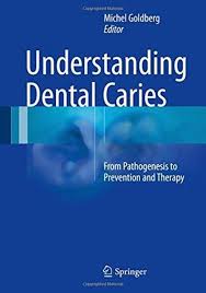Understanding Dental Caries Ebook Pdf Free Download From Pathogenesis To Prevention And Therapy Edited By Michel Goldberg Publisher Springer Download Free