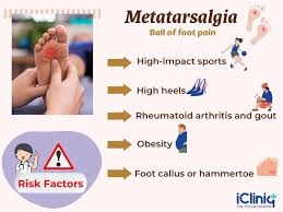 Image result for Metatarsalgia