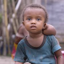 No child should endure what little Armella experienced. A tumor began to  develop behind her ear. Local doctors couldn't help. She needed surgery,  which was made possible by caring friends like you. ...