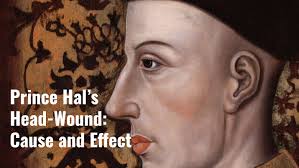 Prince Hal's Head-Wound: Cause and Effect