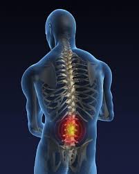 Pin On Lower Back Pain Relief And Remedies