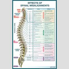 Effects Of Spinal Misalignments Poster