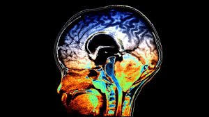 Watch the following video to find out the answers A Brain Cancer Regimen S Toll On Young Memories Research Highlights