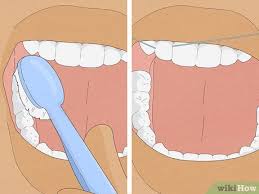 Most often, a dentist will suggest you come back in six months if they have found the beginning stages of a cavity. 6 Ways To Treat Cavities Wikihow