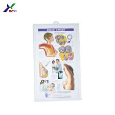 Anatomical Poster Dermatology Breast And Cancer 3d Chart Buy Breast And Cancer 3d Chart Anatomical Poster Medical Plastic 3d Poster Product On