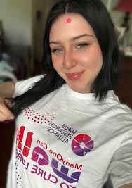 Lupus Natural Remedies and Treatments