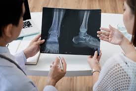 Perbedaan fungsi include() dan require(). Soft Vs Hard Tissue Damage After An Accident