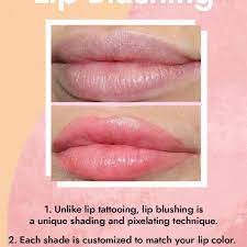 Is it possible to remove a tattoo of eight tiny letters on the inside of your lip? What Is Lip Blushing We Asked Skin Experts