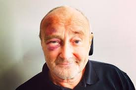 Explore philcollins2008's photos on flickr. Phil Collins Postpones Comeback Tour After Injuring Himself In A Fall Consequence