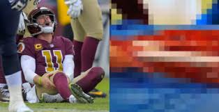 Alex Smith S Bone Was Completely Exposed A Week After His Injury And 8 Surgeries Video Pic Total Pro Sports