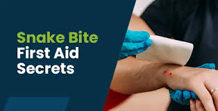 Image result for Snake Bite
