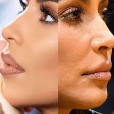 Healthy skin is not synonymous with perfect skin