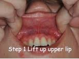 Image result for Lip Exam