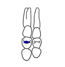 Dental Charting Flashcards Cram Com