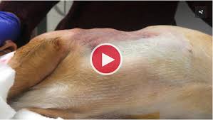 Image result for Flail Chest