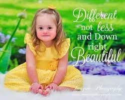 Down Syndrome I Think This May Be My Favorite Quote It S Perfect I Instantly Think Of My Sister Down Syndrome Kids Down Syndrome Down Syndrome Baby