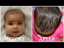 How To Regrow Edges On Natural Hair Fast Youtube Baby Hair Growth Grow Baby Hair Baby Hairstyles