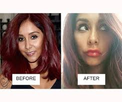 How about love chocolate milk. 25 Most Popular Celebrities With Lip Fillers Before And After With Images