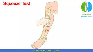 Image result for Ankle External Rotation Test