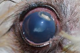 Image result for Eye Foreign Body