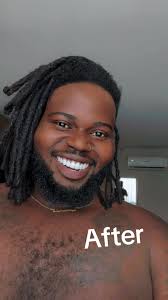 Young Men with Dentures