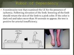 Test For Peripheral Arterial And Venous Circulation