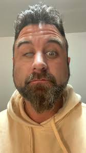 🏴‍☠️ Shara 'Bullet' Magomedov's eye after his fight with Armen Petrosyan  at #UFC308 👁