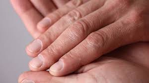 Early sympathetic activation in the initial clinical stages of chronic renal failure. What Your Nails Say About Your Health Everyday Health