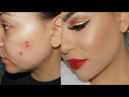 makeup cystic acne acne s