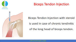Image result for Biceps Tendon Injection