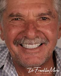 SONRISAS QUE VERDADERAMENTE CAMBIAN VIDAS. TORONTO BAR TRILOR + ZIRCONIO +  NEXCO TEAM WORK Clínica: Dr Franklin Mora. Surgery: @dr_erickdiaz TD:  @td_jose_porras Digital Design: @td.elisa_solano  @laboratoriodentalprostodent @orisdigitaldentistry MIS ...