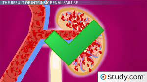 What is renal failure and why does it happen? Acute Renal Failure Intrinsic Renal Failure Its Consequences Video Lesson Transcript Study Com