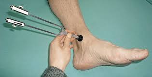 The medial malleolus is a spherical bony protrusion just above the ankle on the inside of the leg. Gangstorungen Auch An Nervenschaden Denken Doctors Today