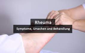 Rheuma Ursachen Symptome Behandlung Praktischarzt