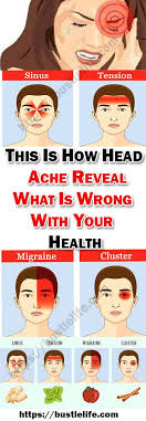 This Is How Head Ache Reveal What Is Wrong With Your Health Headache Aches Home Remedy For Headache