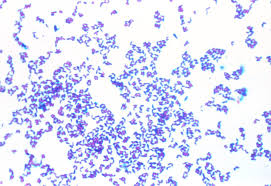 Image result for Corynebacterium