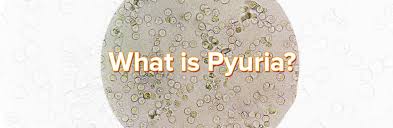 Why Are My Pus Cells High (6-8 Hpf), With Negative Nitrites And Negative  Urine Culture Reports? I Am 35 Male. - Quora