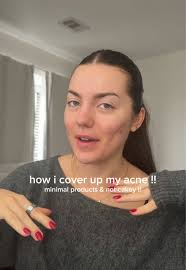 the long awaited acne makeup tutorial 👏🏼 ik im not this crazy makeup girl  but this is JUST enough to cover and not feel like ur wearing makeup #acne  #acnemakeup #makeuptutorial @NARS Cosmetics @Makeup ...