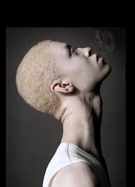 the beauty of being an albino yes we are humans too shaun ross albino model albino human