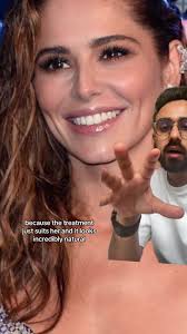 Cheryl's Stunning Teeth Transformation with Composite Veneers