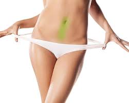 Back of neck $100 front of neck $100 lower legs $125 upper legs $125 buttocks $125 lower back $125 line below belly button $100. Belly Button Laser Hair Removal Package Vs Medspa