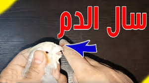 هل جربت عضة هذه الطيور من قبل شعرت بالدوخان في اخر الفيديوا هدا هو birds bird parrot