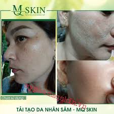 Video bàn thắng lịch thi đấu. Lam Cach Nao Da Nhanh Bong Khi Dung Serum Thay Da Nhan Sam Mqskin Báº¡n Ä'a Hiá»ƒu Ä'ung Cach